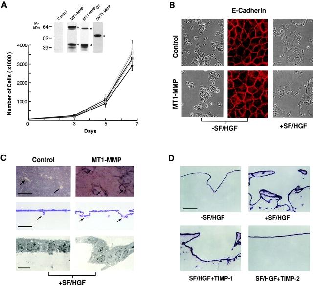 https://cdn.ncbi.nlm.nih.gov/pmc/blobs/95a5/2175112/af38b42f276e/JCB0003080.f3.jpg