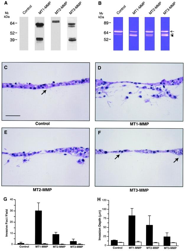 https://cdn.ncbi.nlm.nih.gov/pmc/blobs/95a5/2175112/c8c205a71640/JCB0003080.f7.jpg