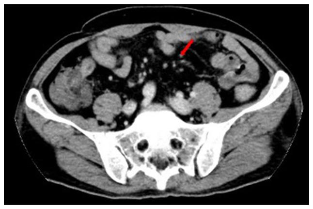 https://cdn.ncbi.nlm.nih.gov/pmc/blobs/95aa/11130743/a2d458fd82db/ol-28-01-14458-g01.jpg