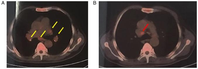 https://cdn.ncbi.nlm.nih.gov/pmc/blobs/95aa/11130743/e64ba308e916/ol-28-01-14458-g02.jpg