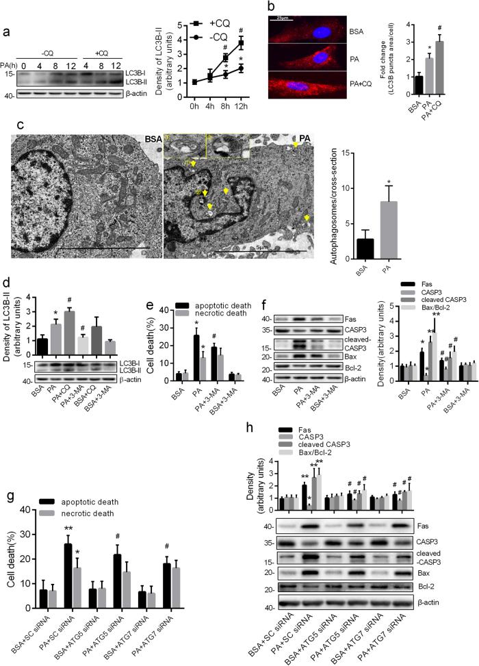 https://cdn.ncbi.nlm.nih.gov/pmc/blobs/95ad/6039485/3c4627209a10/41419_2018_795_Fig1_HTML.jpg