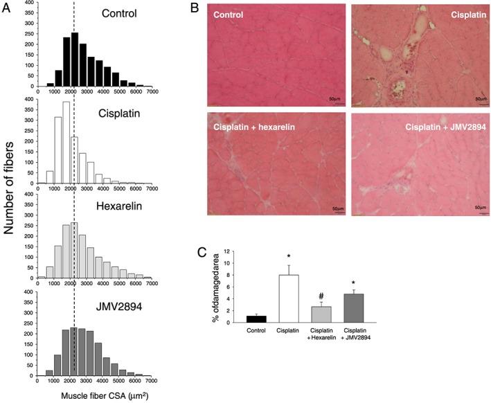 https://cdn.ncbi.nlm.nih.gov/pmc/blobs/95b8/5703021/87bcfa78ea01/JCSM-8-386-g003.jpg