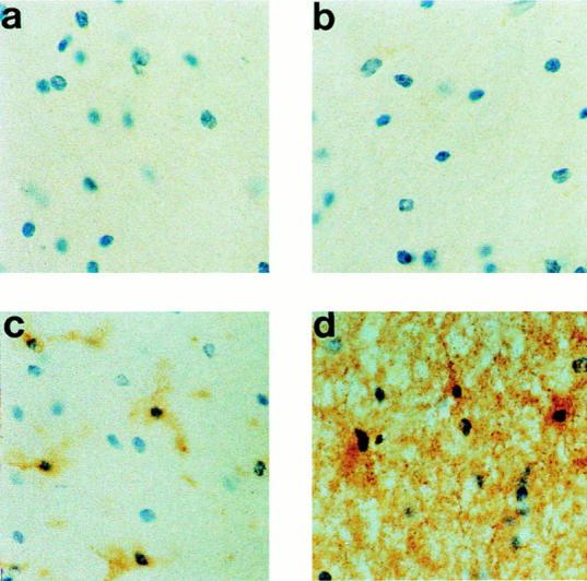 https://cdn.ncbi.nlm.nih.gov/pmc/blobs/95bf/2212151/23b80e4c1215/JEM971084.f8.jpg