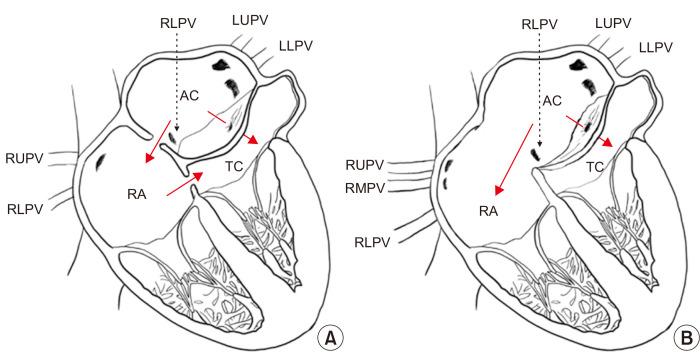 https://cdn.ncbi.nlm.nih.gov/pmc/blobs/95c0/9005945/e18d55b66c24/jcs-55-2-151-f1.jpg