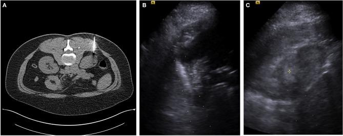 https://cdn.ncbi.nlm.nih.gov/pmc/blobs/95d8/3437570/8839a84414b4/fonc-02-00106-g0001.jpg