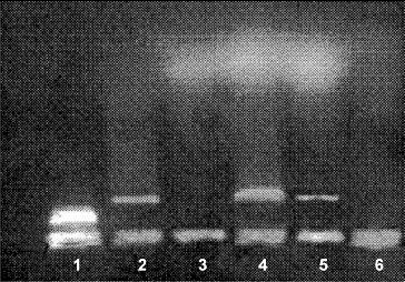 https://cdn.ncbi.nlm.nih.gov/pmc/blobs/95db/4434040/95fdf54eddf4/tbeq-29-092-g002.jpg