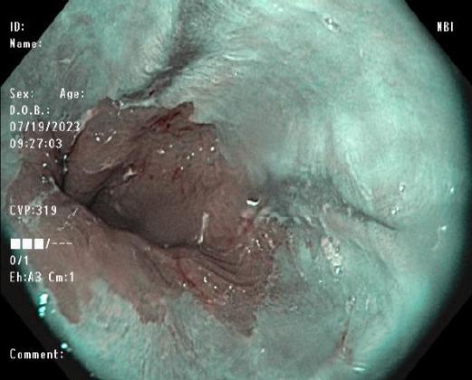 https://cdn.ncbi.nlm.nih.gov/pmc/blobs/95e7/10665616/1f9e58f919f9/ce-2023-182f2.jpg