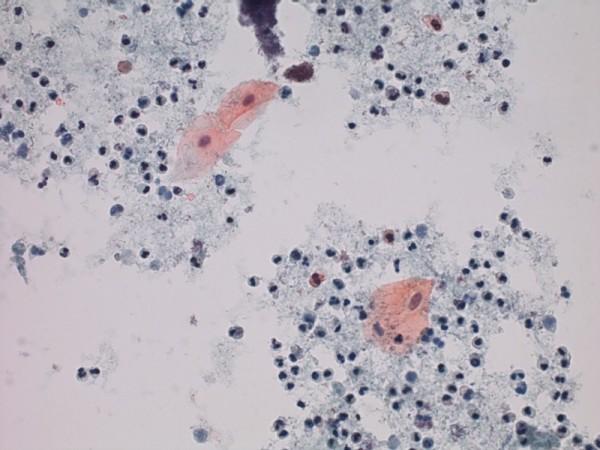 https://cdn.ncbi.nlm.nih.gov/pmc/blobs/95ec/2803994/35655e9e5ab0/1757-1626-2-9335-6.jpg