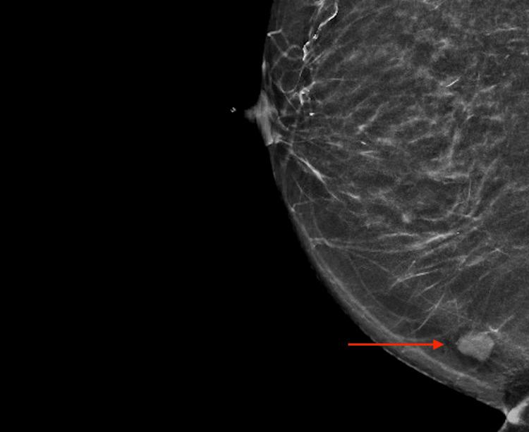 https://cdn.ncbi.nlm.nih.gov/pmc/blobs/95ed/9949736/dcd7f1a7fd9a/cureus-0015-00000034164-i03.jpg