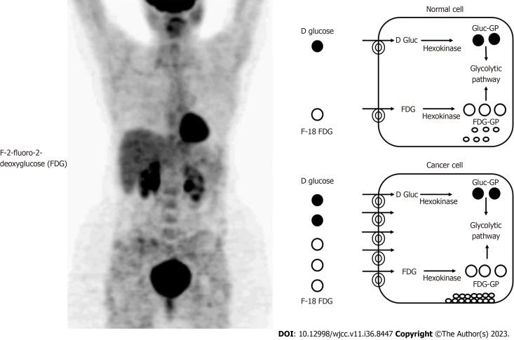 https://cdn.ncbi.nlm.nih.gov/pmc/blobs/9603/10768499/7667ffe3f9e1/WJCC-11-8447-g003.jpg