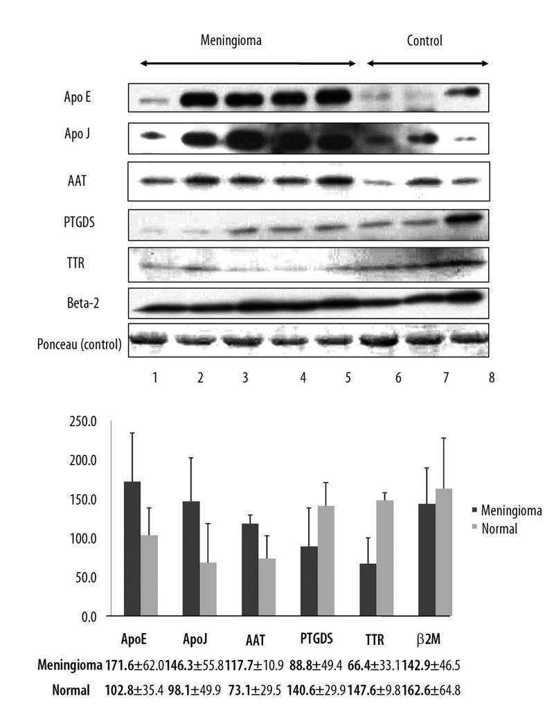 https://cdn.ncbi.nlm.nih.gov/pmc/blobs/9603/3560610/443e000a0365/medscimonit-18-11-BR450-g003.jpg