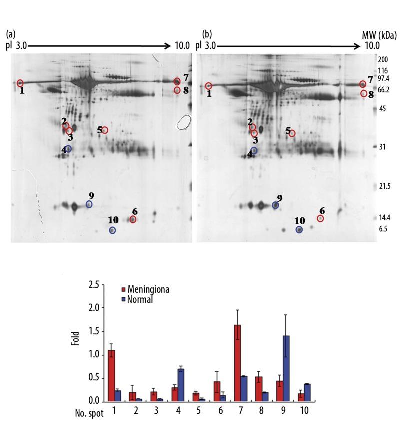 https://cdn.ncbi.nlm.nih.gov/pmc/blobs/9603/3560610/ce466a8930ee/medscimonit-18-11-BR450-g001.jpg