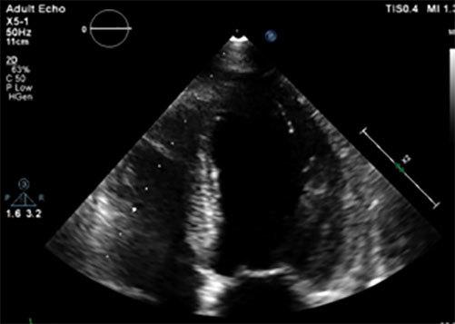 https://cdn.ncbi.nlm.nih.gov/pmc/blobs/9605/6346755/a13bc1c37967/760_Fig2.jpg