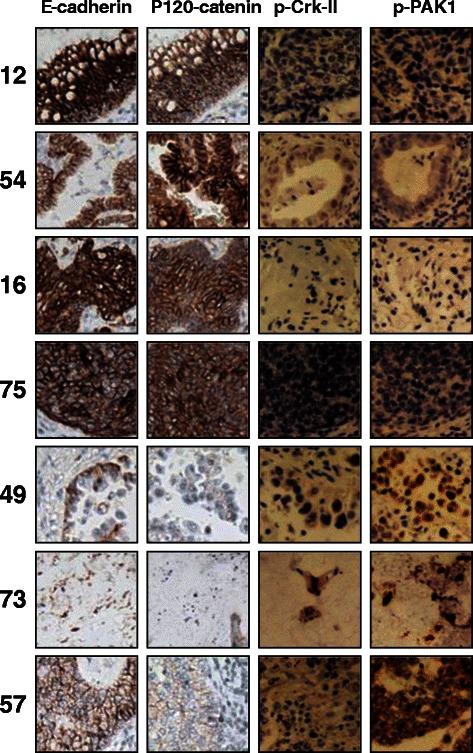 https://cdn.ncbi.nlm.nih.gov/pmc/blobs/9613/4477307/822c66d86950/12885_2015_1360_Fig1_HTML.jpg