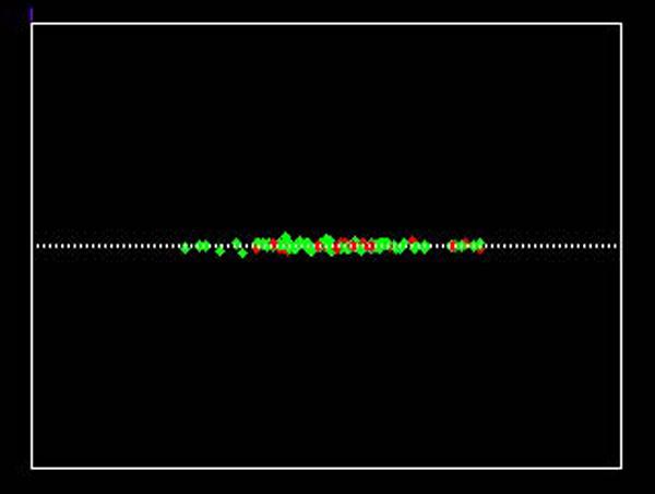 https://cdn.ncbi.nlm.nih.gov/pmc/blobs/9615/5567244/a191e286fc84/41114_2016_10_Fig7.jpg