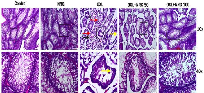 https://cdn.ncbi.nlm.nih.gov/pmc/blobs/961a/10897554/8655cfaf6831/IJBMS-27-466-g006.jpg