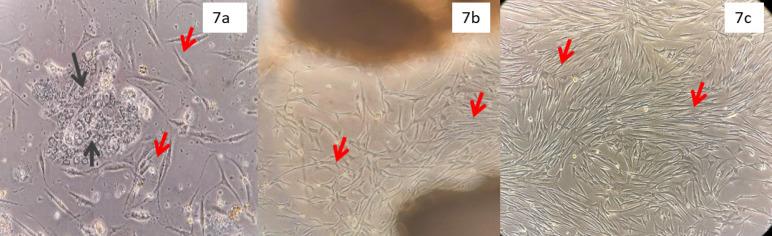 https://cdn.ncbi.nlm.nih.gov/pmc/blobs/961b/10152870/5501f7c5de60/APJCP-24-257-g007.jpg