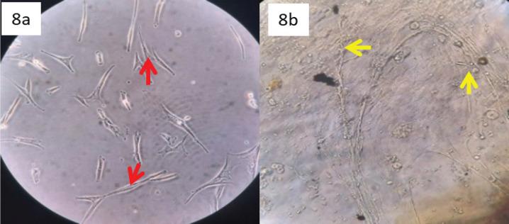 https://cdn.ncbi.nlm.nih.gov/pmc/blobs/961b/10152870/58455f608f5a/APJCP-24-257-g008.jpg