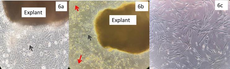 https://cdn.ncbi.nlm.nih.gov/pmc/blobs/961b/10152870/79be71bf4754/APJCP-24-257-g006.jpg
