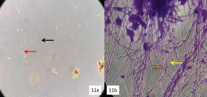 https://cdn.ncbi.nlm.nih.gov/pmc/blobs/961b/10152870/d0ee3b942de4/APJCP-24-257-g011.jpg