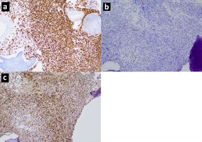 https://cdn.ncbi.nlm.nih.gov/pmc/blobs/9624/11650554/6b616898710f/jh-13-268-g003.jpg