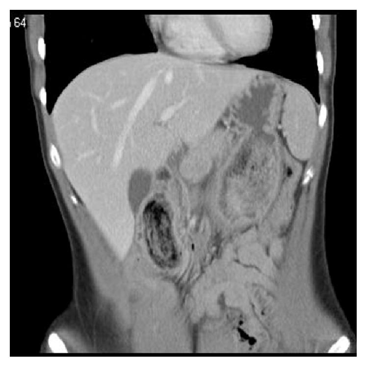 https://cdn.ncbi.nlm.nih.gov/pmc/blobs/962a/4842028/9ad020f7e021/CRIS2016-7638504.001.jpg