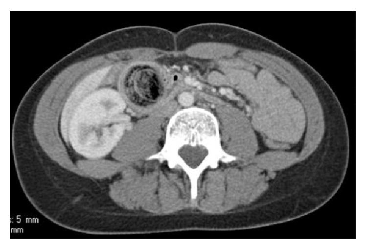 https://cdn.ncbi.nlm.nih.gov/pmc/blobs/962a/4842028/d5638bcbfa95/CRIS2016-7638504.002.jpg