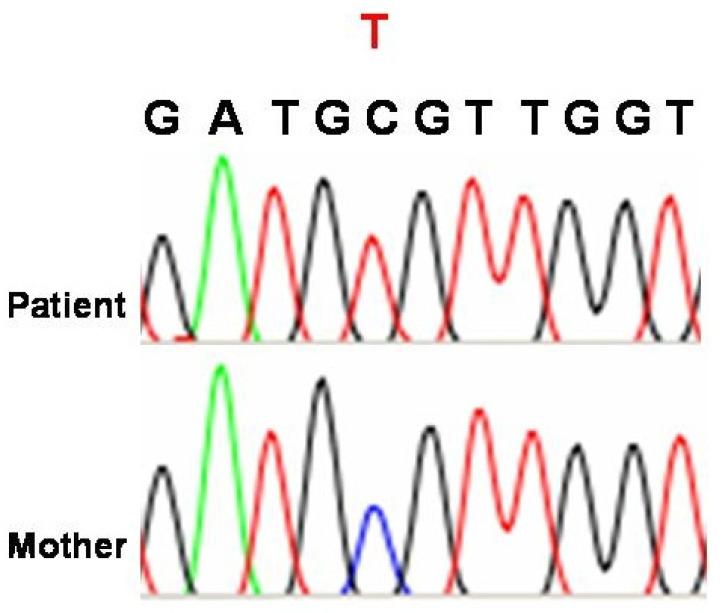 https://cdn.ncbi.nlm.nih.gov/pmc/blobs/962b/12027479/ab6822ec967b/genes-16-00465-g002.jpg