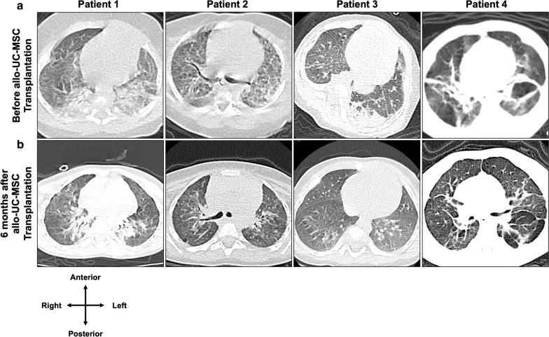 https://cdn.ncbi.nlm.nih.gov/pmc/blobs/9630/7576694/16e7e322af58/12967_2020_2568_Fig2_HTML.jpg
