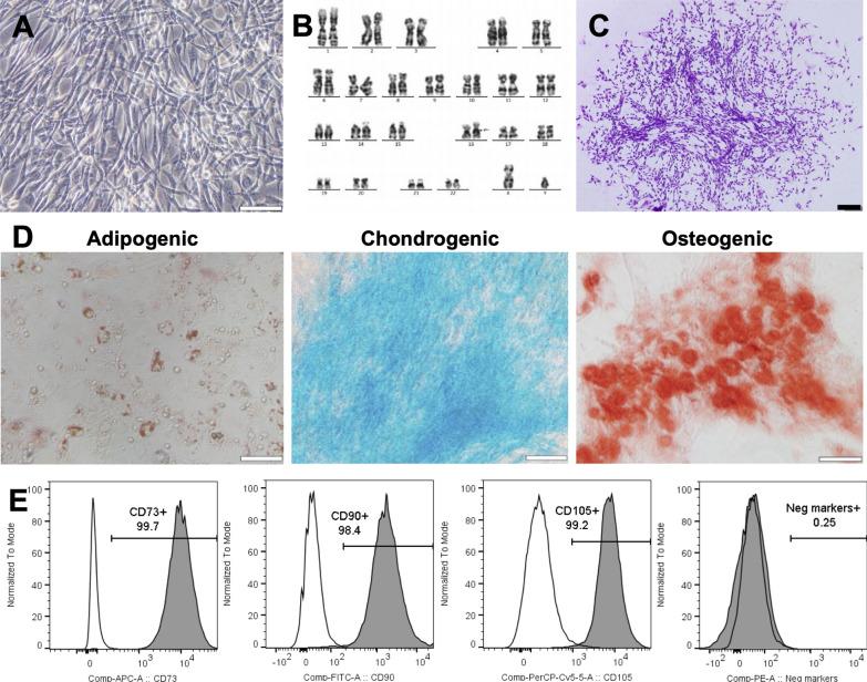 https://cdn.ncbi.nlm.nih.gov/pmc/blobs/9630/7576694/1f795f1602ca/12967_2020_2568_Fig1_HTML.jpg