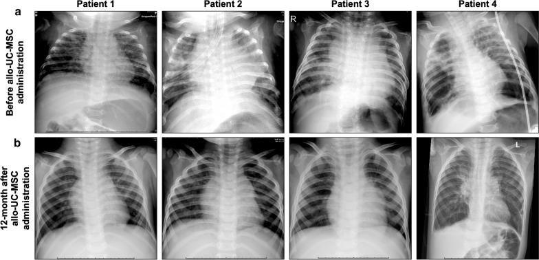 https://cdn.ncbi.nlm.nih.gov/pmc/blobs/9630/7576694/53b4c67ade44/12967_2020_2568_Fig3_HTML.jpg
