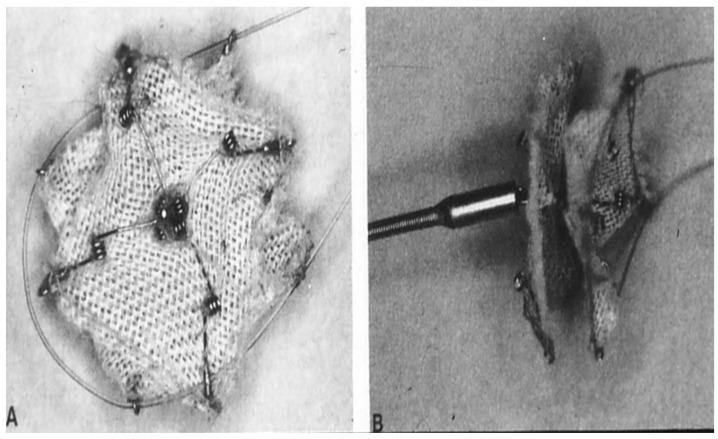 https://cdn.ncbi.nlm.nih.gov/pmc/blobs/9632/7552712/4c55fecc38db/children-07-00111-g004.jpg