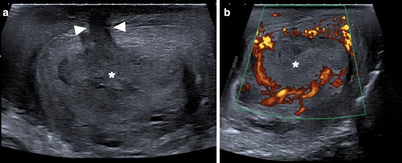 https://cdn.ncbi.nlm.nih.gov/pmc/blobs/9637/8263845/05a000e4158c/13244_2021_1046_Fig6_HTML.jpg
