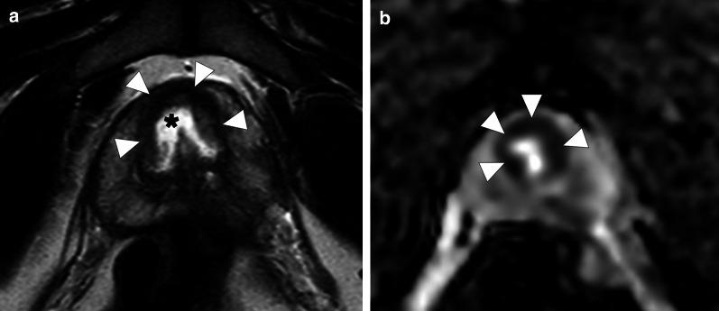 https://cdn.ncbi.nlm.nih.gov/pmc/blobs/9637/8263845/25f7ce100d96/13244_2021_1046_Fig2_HTML.jpg