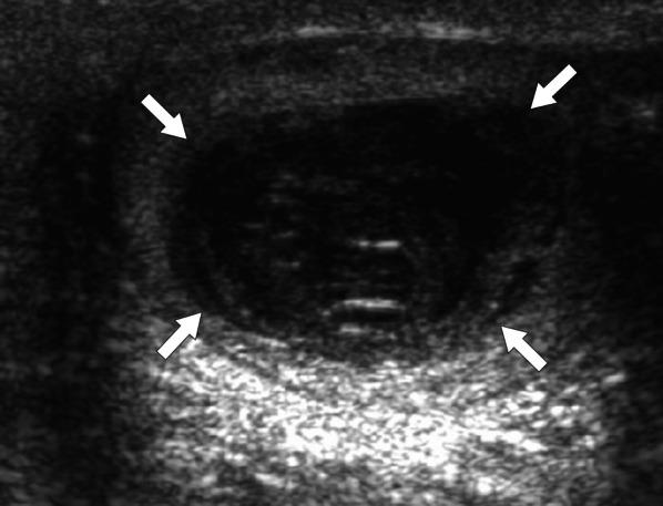 https://cdn.ncbi.nlm.nih.gov/pmc/blobs/9637/8263845/85a456587d71/13244_2021_1046_Fig11_HTML.jpg