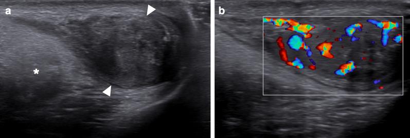 https://cdn.ncbi.nlm.nih.gov/pmc/blobs/9637/8263845/ab1f9e441d20/13244_2021_1046_Fig22_HTML.jpg