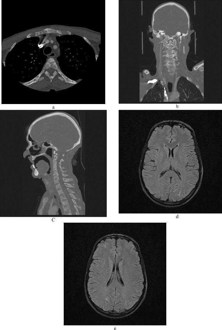 https://cdn.ncbi.nlm.nih.gov/pmc/blobs/963b/8245838/fbffb2c46320/GHFBB-14-276-g001.jpg
