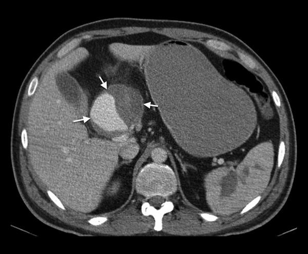 https://cdn.ncbi.nlm.nih.gov/pmc/blobs/963e/4489684/900c20ea29bc/poljradiol-80-334-g002.jpg