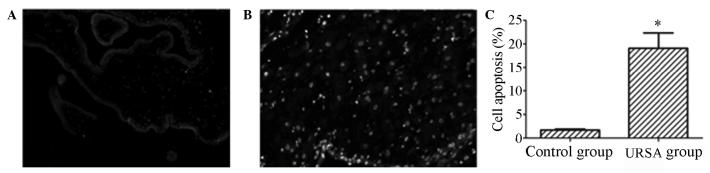 https://cdn.ncbi.nlm.nih.gov/pmc/blobs/9644/3861175/913f700d14ea/ETM-07-01-0191-g01.jpg