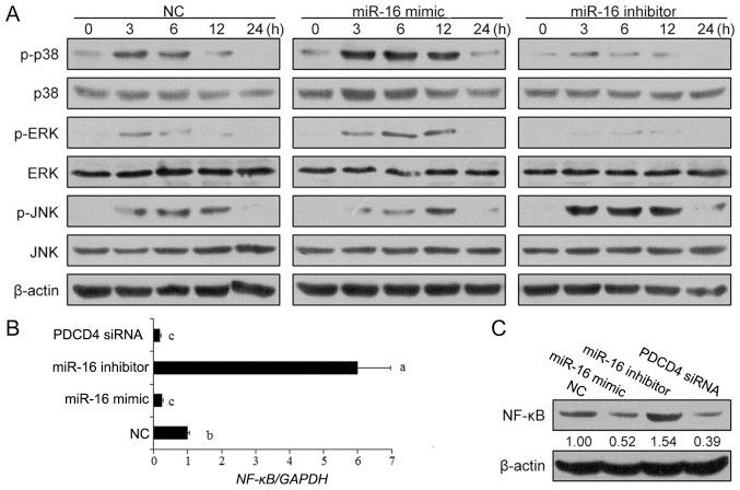 https://cdn.ncbi.nlm.nih.gov/pmc/blobs/9645/4790696/f0280066e9dc/IJMM-37-04-0967-g04.jpg