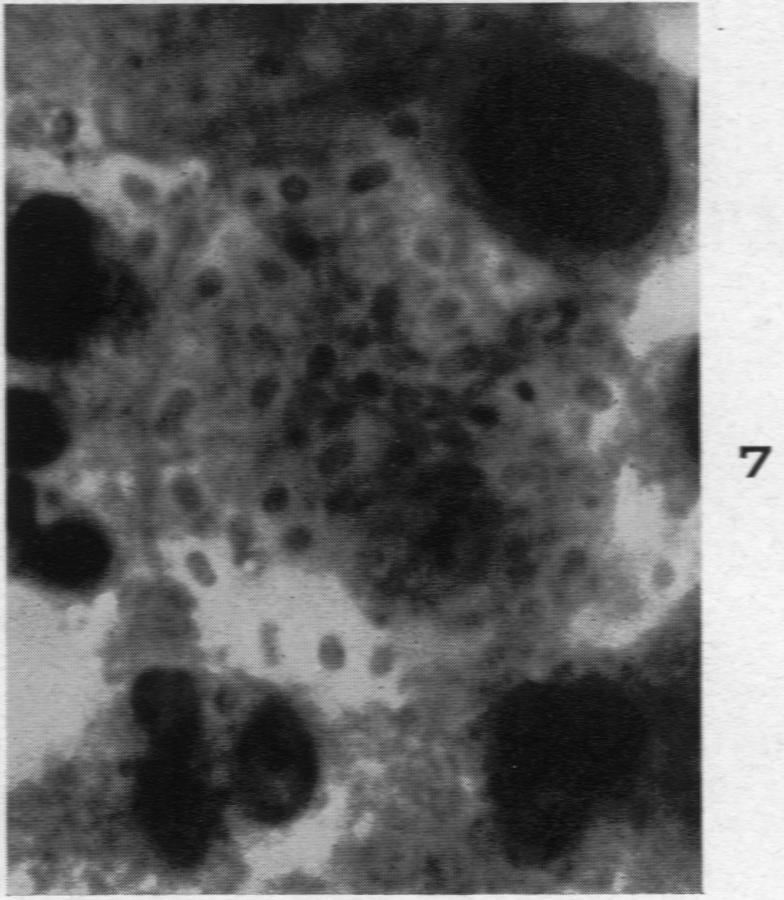 https://cdn.ncbi.nlm.nih.gov/pmc/blobs/964b/1934112/3ec69f2e7b58/amjpathol00512-0157-g.jpg