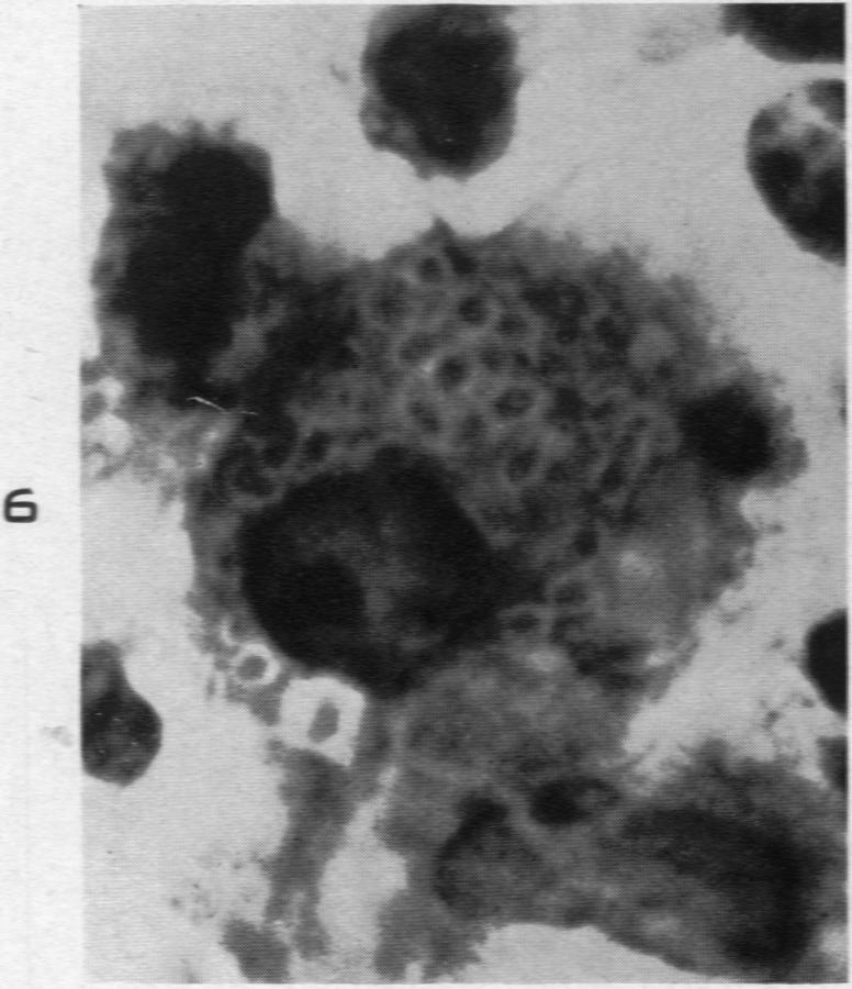 https://cdn.ncbi.nlm.nih.gov/pmc/blobs/964b/1934112/8544fdcd4a8c/amjpathol00512-0157-f.jpg