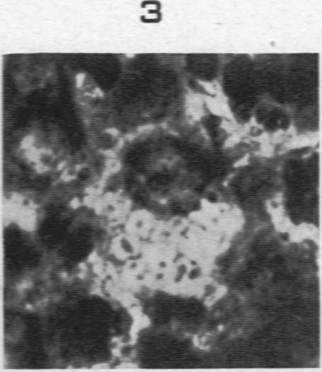 https://cdn.ncbi.nlm.nih.gov/pmc/blobs/964b/1934112/bf274c664964/amjpathol00512-0157-c.jpg