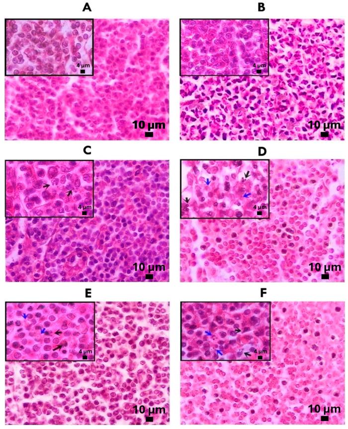 https://cdn.ncbi.nlm.nih.gov/pmc/blobs/964c/11085222/7f4fb987e268/molecules-29-01956-g004.jpg