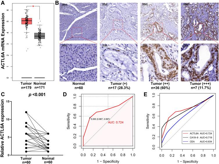 https://cdn.ncbi.nlm.nih.gov/pmc/blobs/964e/8722579/0ea54dcff6eb/CMAR-13-9467-g0001.jpg