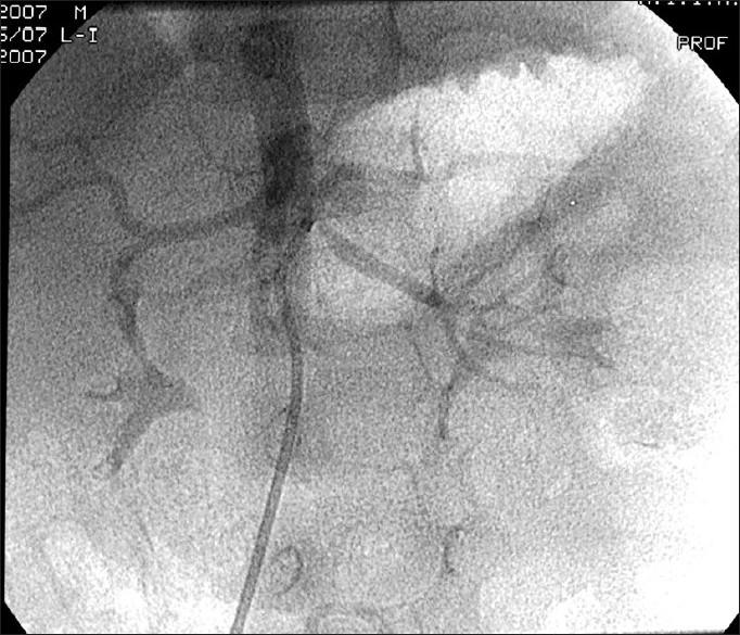 https://cdn.ncbi.nlm.nih.gov/pmc/blobs/965f/2922669/1fa93880a2c6/APC-2-167-g003.jpg