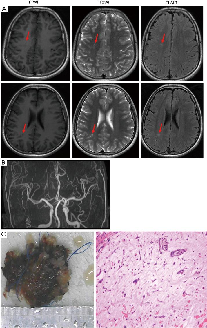 https://cdn.ncbi.nlm.nih.gov/pmc/blobs/9664/8825931/24a998f2a8bf/tp-11-01-149-f1.jpg