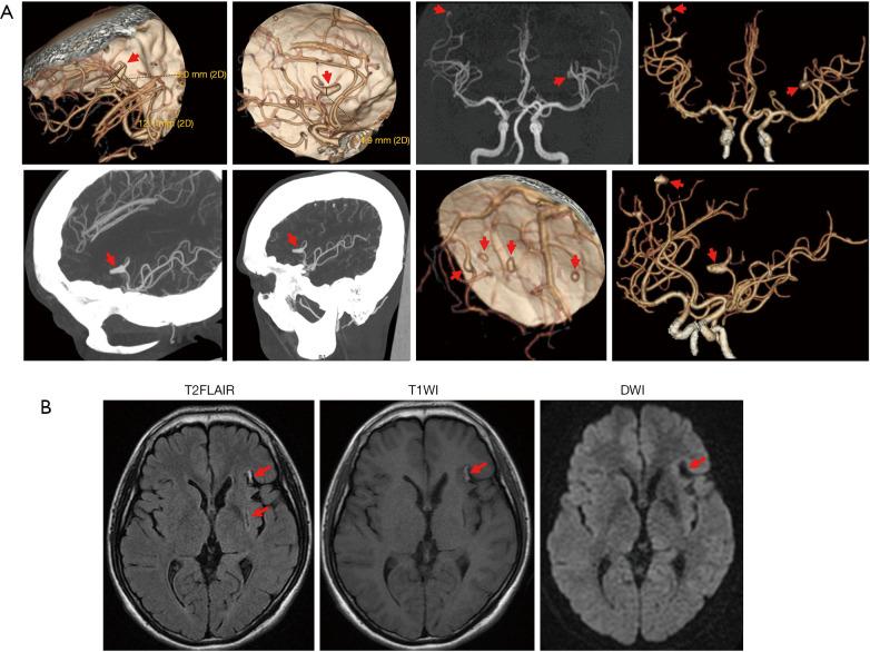 https://cdn.ncbi.nlm.nih.gov/pmc/blobs/9664/8825931/bb2dfb7a1c87/tp-11-01-149-f2.jpg