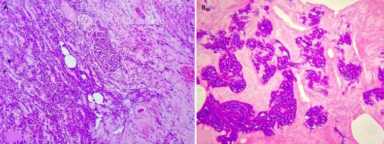 https://cdn.ncbi.nlm.nih.gov/pmc/blobs/9664/9898768/0104743d88c6/PAMJ-43-136-g004.jpg