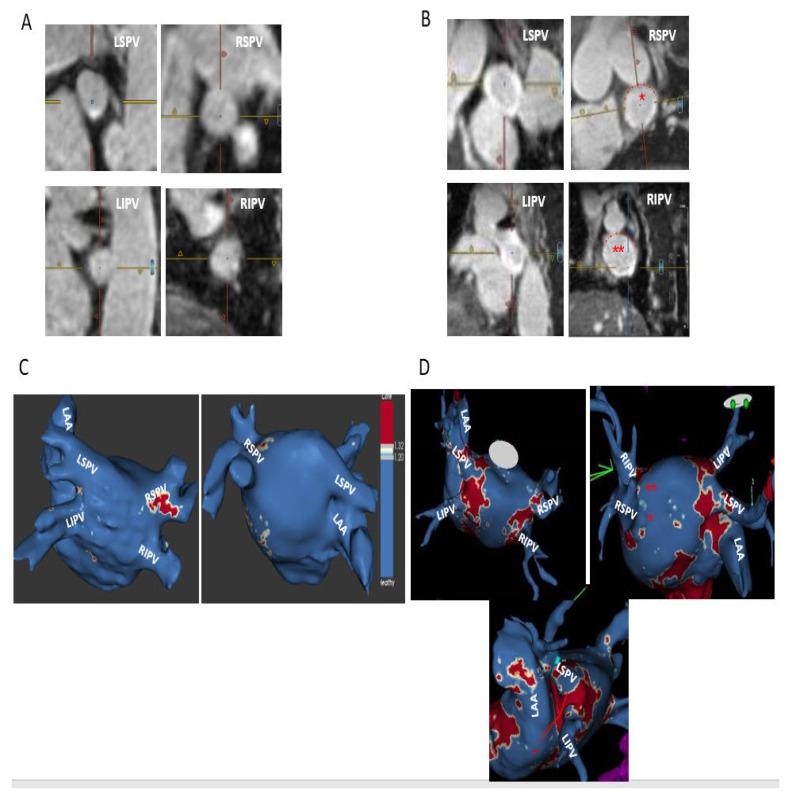 https://cdn.ncbi.nlm.nih.gov/pmc/blobs/9668/10056270/b96d97966a44/jcm-12-02442-g003.jpg